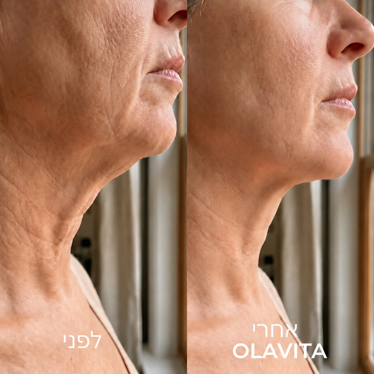 Tri-Lift Peptide Complex™