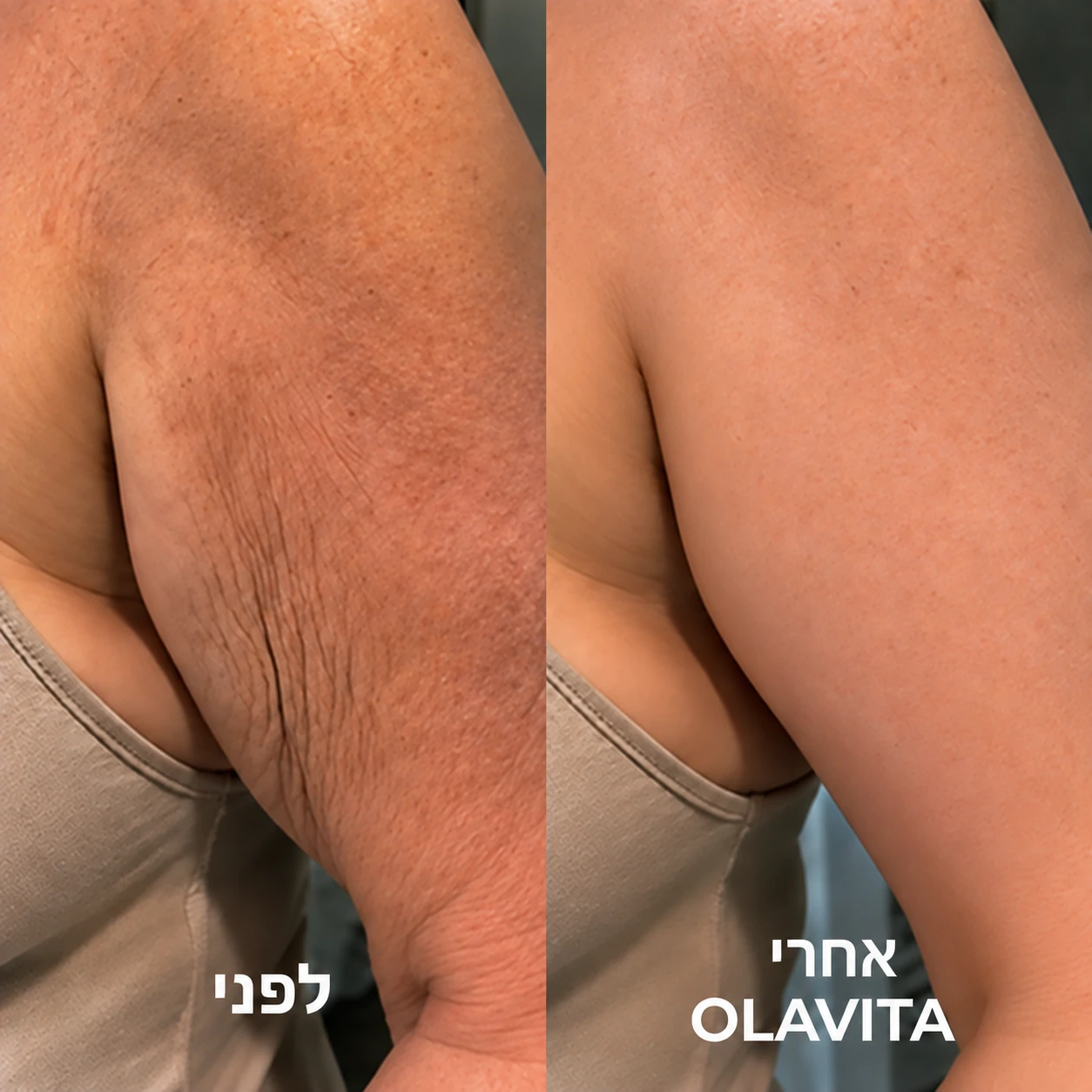 Tri-Lift Peptide Complex™